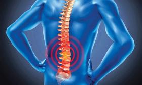 NGUYÊN NHÂN VÀ CÁCH ĐIỀU TRỊ THOÁI HÓA ĐỐT SỐNG
